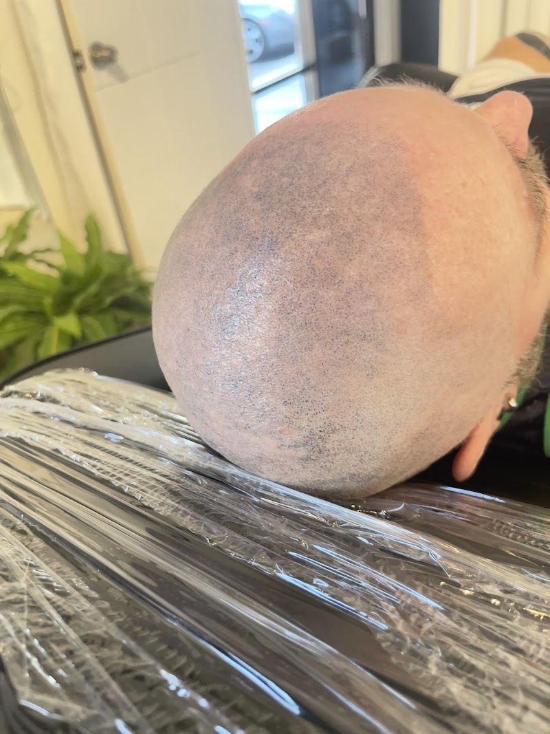 SMP Treatment, San Francisco