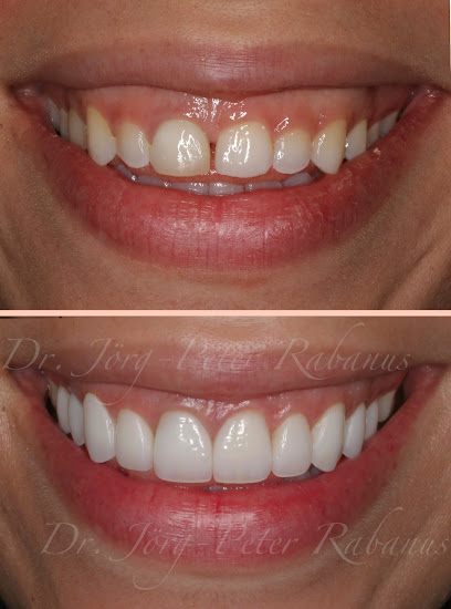 Dr. Jorg-Peter Rabanus, DDS, San Francisco