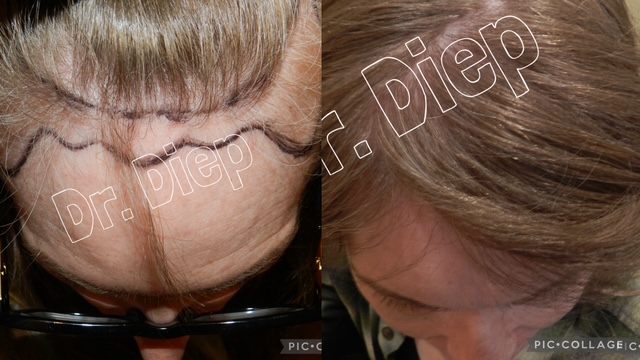 Medical Hair Transplant & Aesthetics, San Francisco